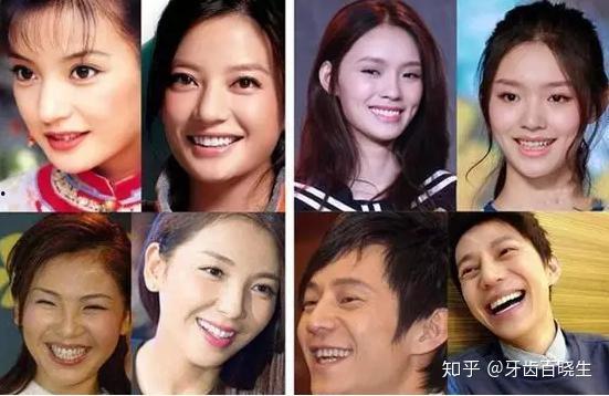 明星烤瓷牙综艺爆料视频,明星烤瓷牙背后的真相与争议