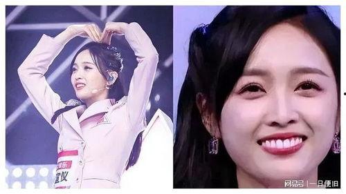 明星烤瓷牙综艺爆料视频,明星烤瓷牙背后的真相与争议  第2张