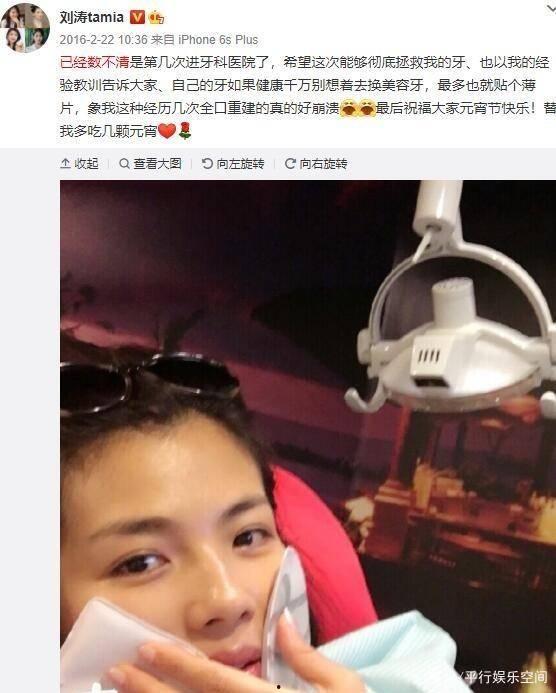 明星烤瓷牙综艺爆料视频,明星烤瓷牙背后的真相与争议  第3张